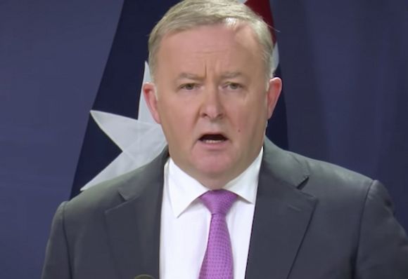 The Opposition under Albo: Albsent without leave