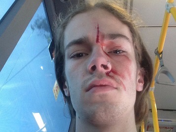 Marriage, Macklemore and inequality in Australia