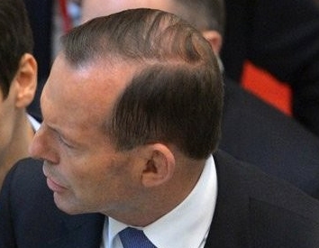 Step aside Bill Shorten: Tony Abbott is the best Opposition Leader in Parliament